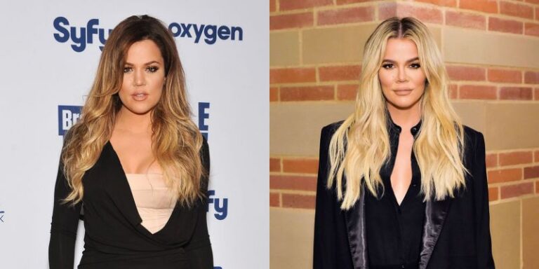 Khloe Kardashian Reveals How Much Plastic Surgery She’s Had